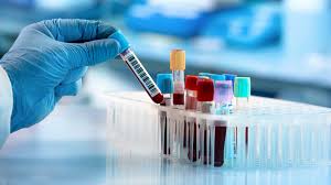 Autoimmune Diseases Diagnostics Market