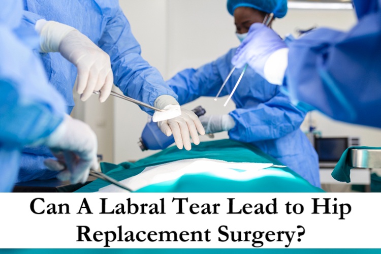 Can A Labral Tear Lead to Hip Replacement Surgery