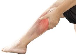 Neuropathic Pain in the Legs