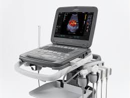 United States Ultrasound Devices Market