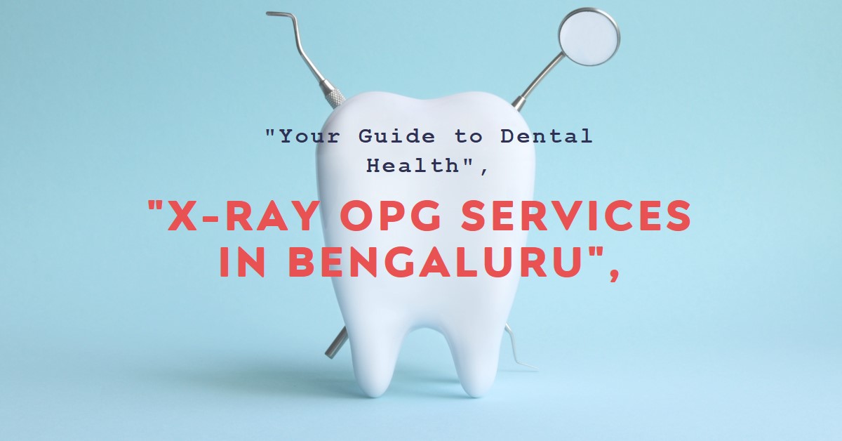 X-Ray OPG Services in Bengaluru