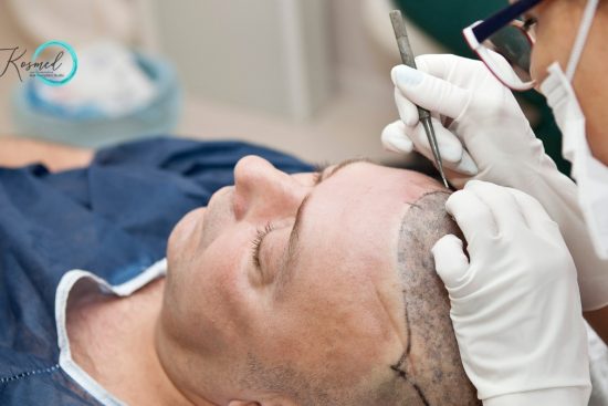 hair transplant in himachal Pradesh