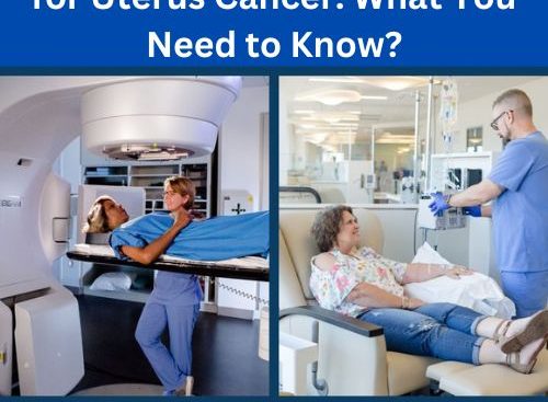 Chemotherapy and Radiation for Uterus Cancer_ What You Need to Know