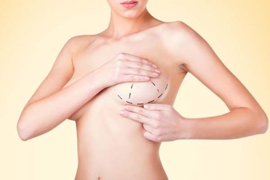 Breast-Augmentation-Surgery