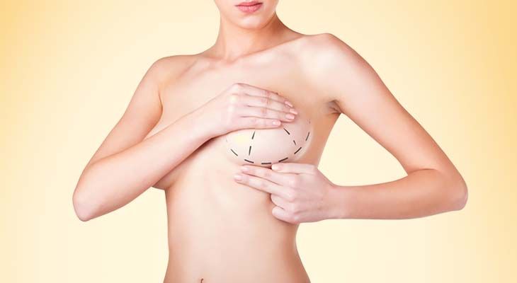 Breast-Augmentation-Surgery