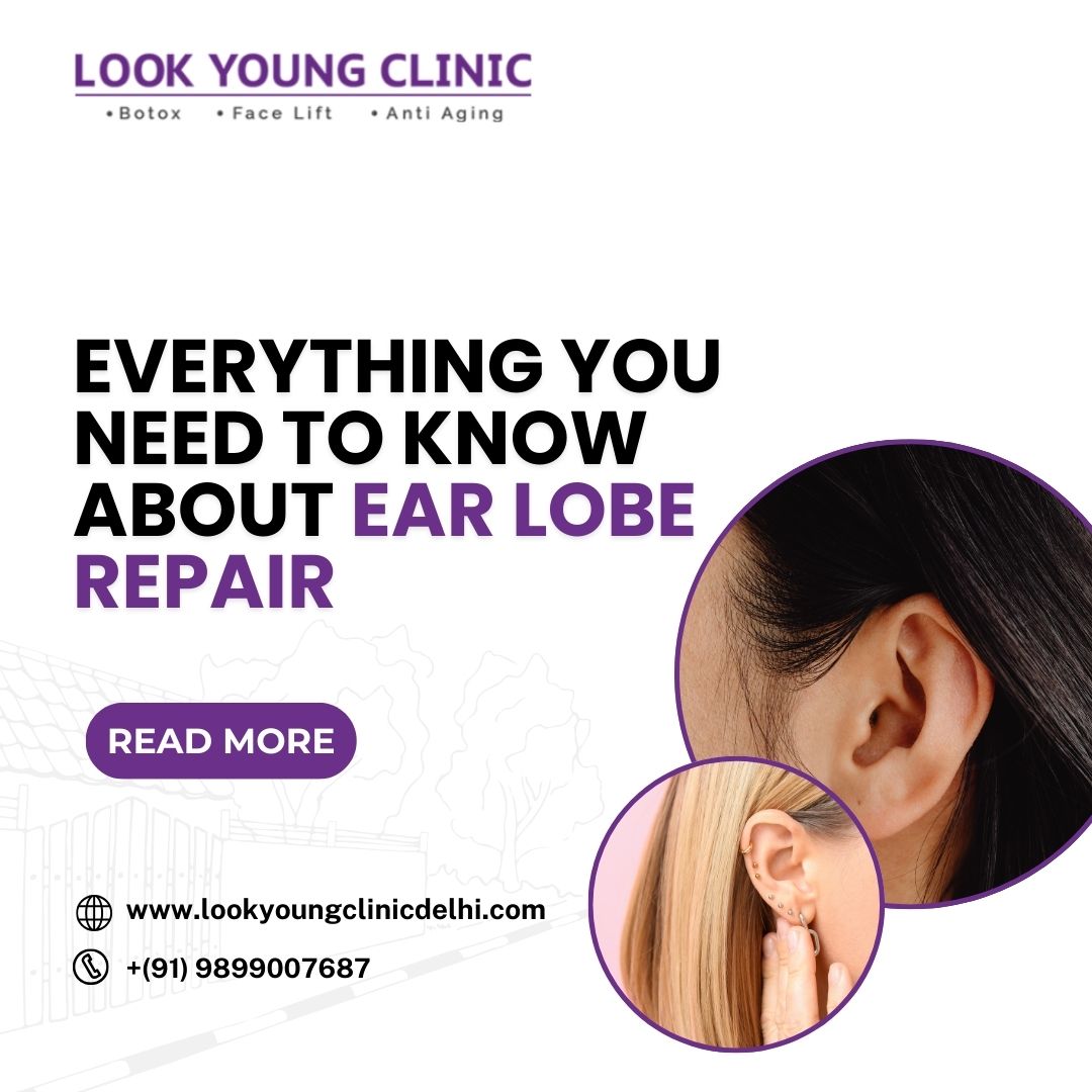 Everything You Need to Know About Ear Lobe Repair