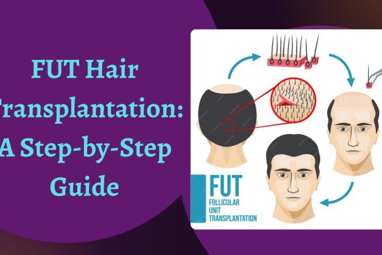 FUT Hair Transplantation A Step-by-Step Guide