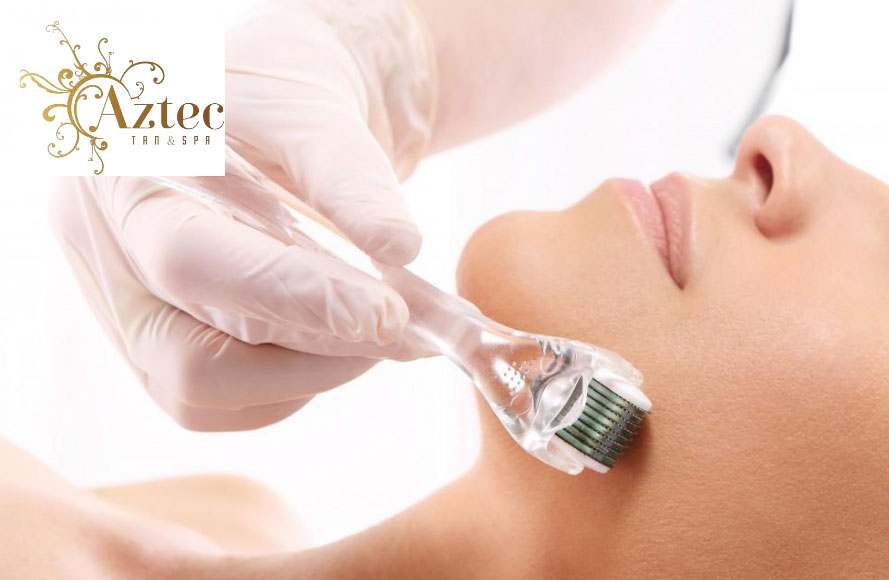 How-Many-Microneedling-Treatments-Do-You-Need