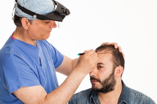 hair transplant regina