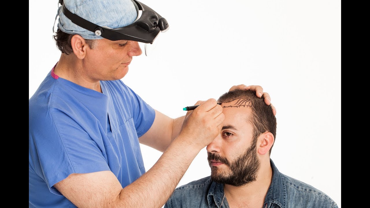 hair transplant regina