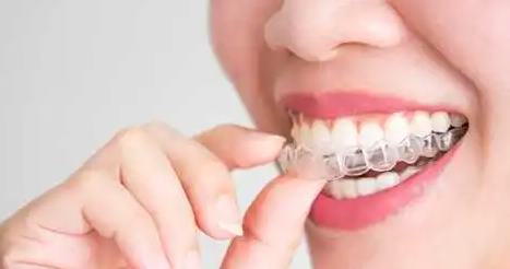 invisalign cost mississauga