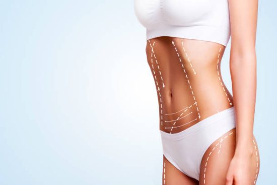 Liposuction Targeting Stubborn Areas